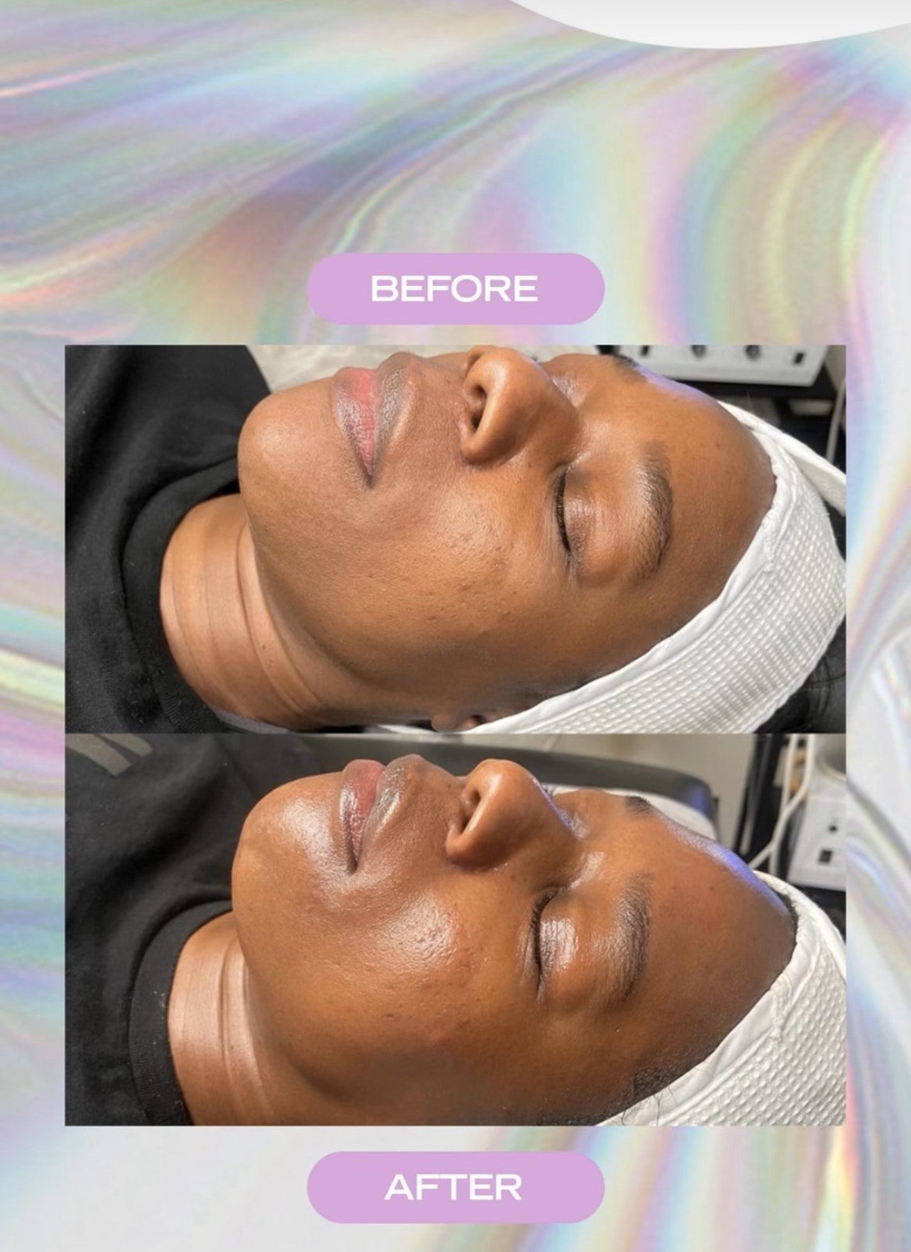 B2GOF GLO2Facial