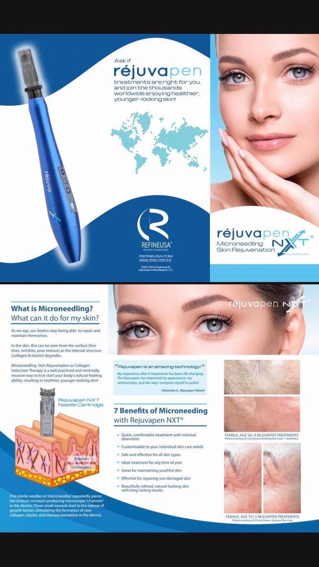 B2GOF MICRONEEDLING